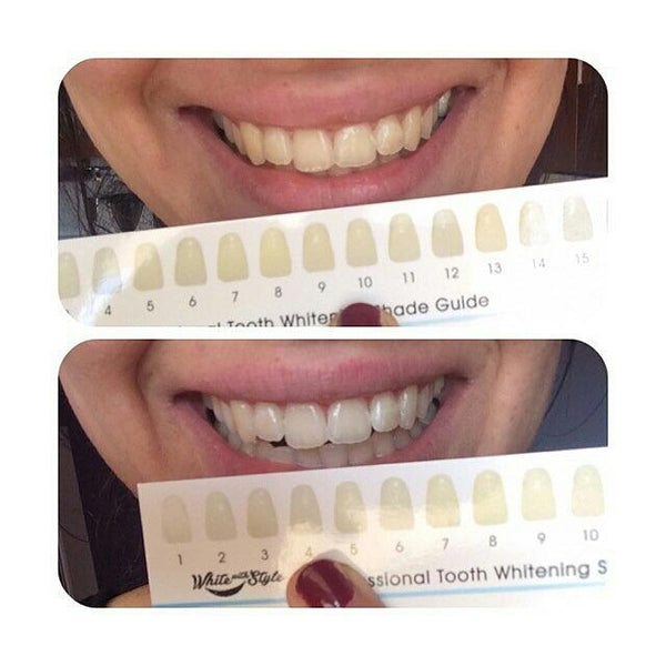 Halloween Special Sparkle White Teeth Whitening Kit w/FREE GIFT