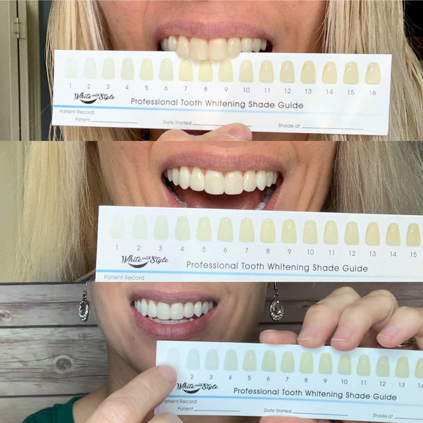 Halloween Special Sparkle White Teeth Whitening Kit w/FREE GIFT